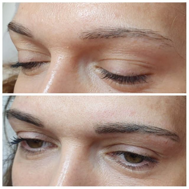 Eyelash extensions Lincoln Aesthetic Dermal Fillers Lincoln Aesthetic